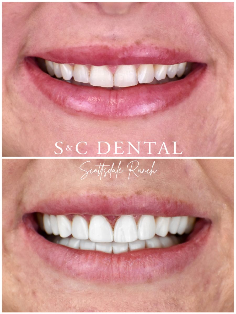 Before and after photo of a patient’s smile treated at S&C Dental Scottsdale Ranch in Scottsdale, AZ - case 8