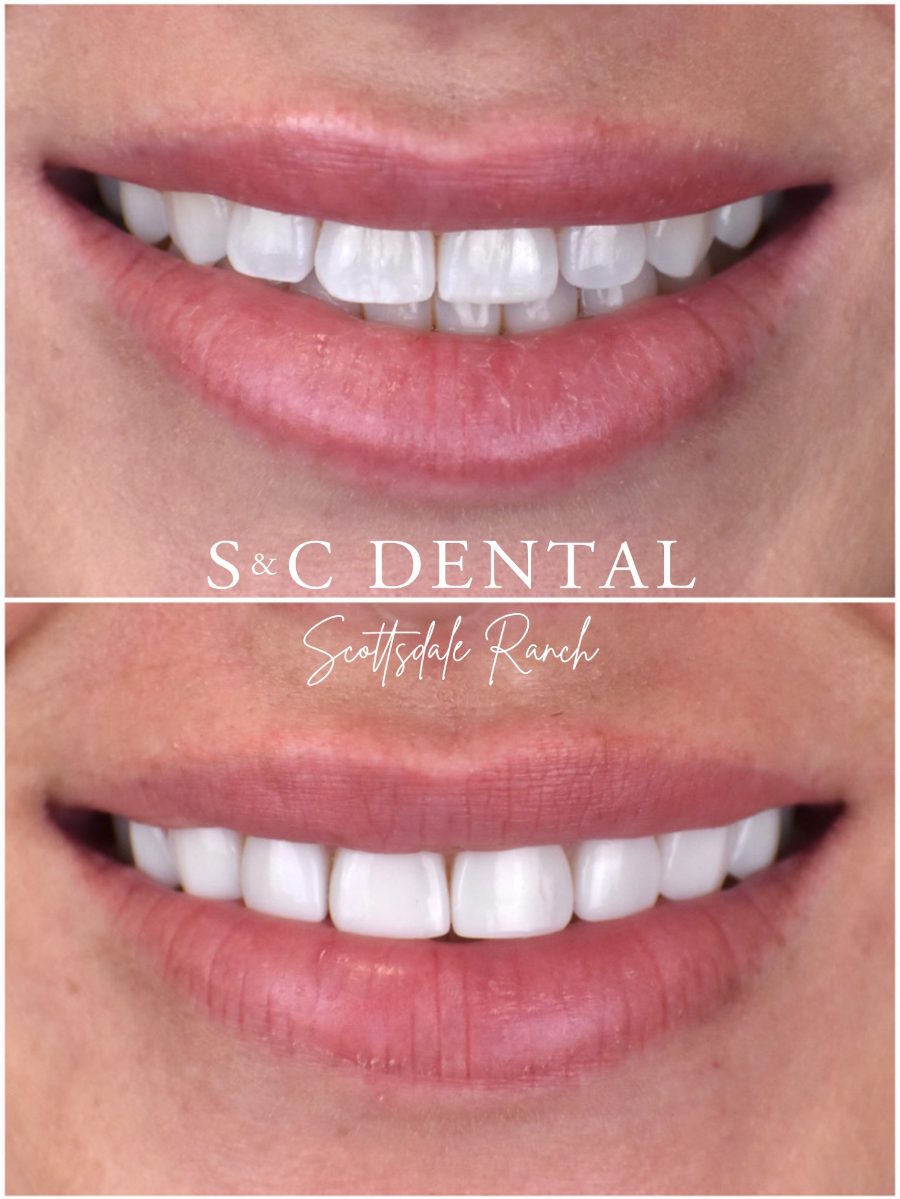 Before and after photo of a patient’s smile treated at S&C Dental Scottsdale Ranch in Scottsdale, AZ - case 9