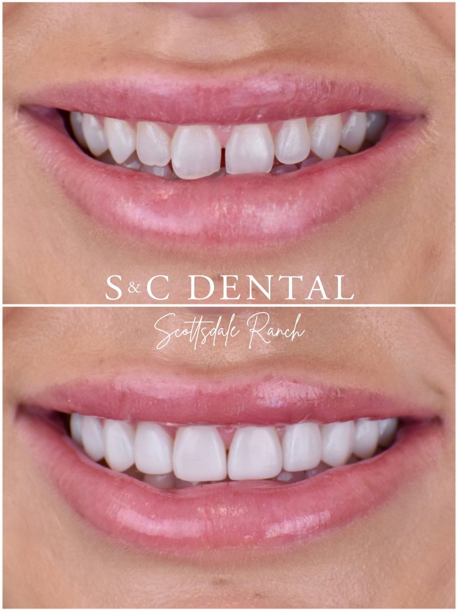 Before and after photo of a patient’s smile treated at S&C Dental Scottsdale Ranch in Scottsdale, AZ - case 13