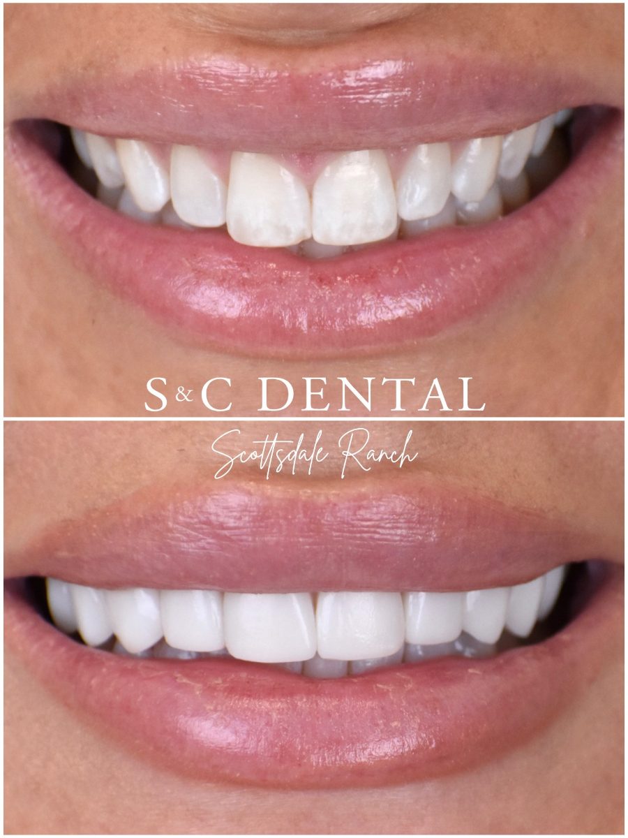 Before and after photo of a patient’s smile treated at S&C Dental Scottsdale Ranch in Scottsdale, AZ - case 15